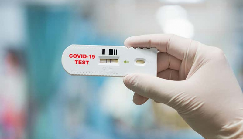 Janvārī skolēniem un skolotājiem būs biežāk jāveic Covid-19 testi