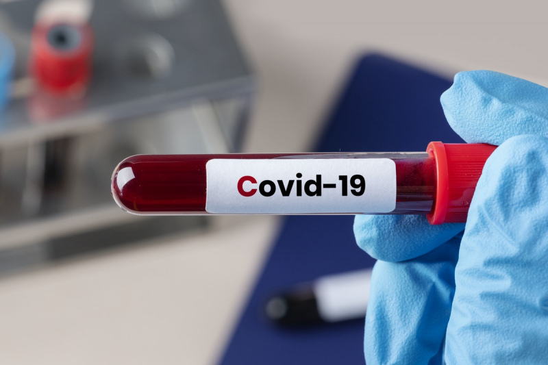 Latvijā atkal pieaug saslimstība ar Covid-19